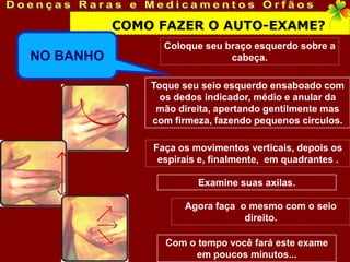 COMO FAZER O AUTO-EXAME?
                 Coloque seu braço esquerdo sobre a
NO BANHO                      cabeça.

               Toque seu seio esquerdo ensaboado com
                 os dedos indicador, médio e anular da
                mão direita, apertando gentilmente mas
               com firmeza, fazendo pequenos círculos.

               Faça os movimentos verticais, depois os
                espirais e, finalmente, em quadrantes .

                        Examine suas axilas.

                     Agora faça o mesmo com o seio
                                 direito.

                 Com o tempo você fará este exame
                      em poucos minutos...
 