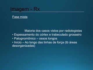 Maioria dos casos vistos por radiologistas
• Espessamento do córtex e trabeculado grosseiro
• Patognomônico – ossos longos
• Início – Ao longo das linhas de força (tb áreas
desorganizadas)
Imagem - Rx
Fase mista
 