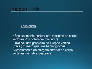 • Espessamento cortical nas margens do corpo
vertebral (“vértebra em moldura”)
• Trabeculado grosseiro na direção vertical
(mais grosseiro que nos hemangiomas)
• Achatamento da margem anterior do corpo
vertebral (vértebra quadrada)
Imagem - Rx
Fase mista
 
