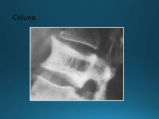 Coluna
 