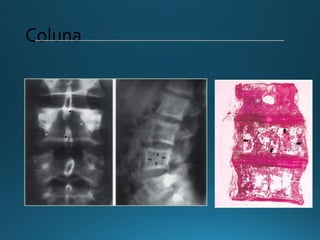 Coluna
 