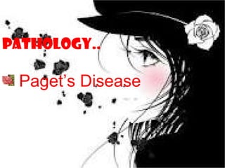 PATHOLOGY..

 Paget’s Disease
 