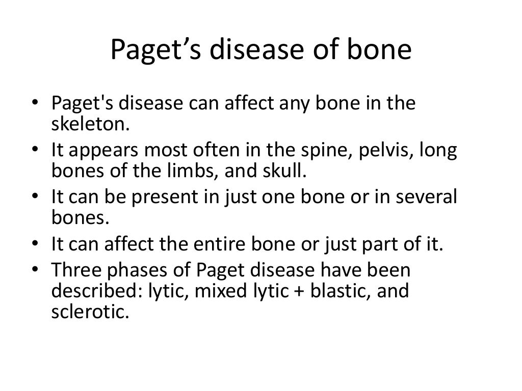 Paget's disease of bone