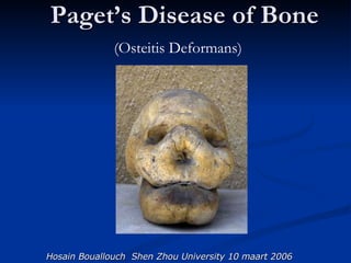 Paget’s Disease of Bone   (Osteitis Deformans)   Hosain Bouallouch  Shen Zhou University 10 maart 2006 
