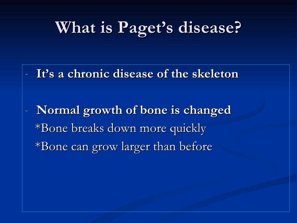Paget’S Disease Of Bone