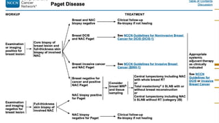 management of Pagets disease of breast .pptx