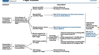 management of Pagets disease of breast .pptx