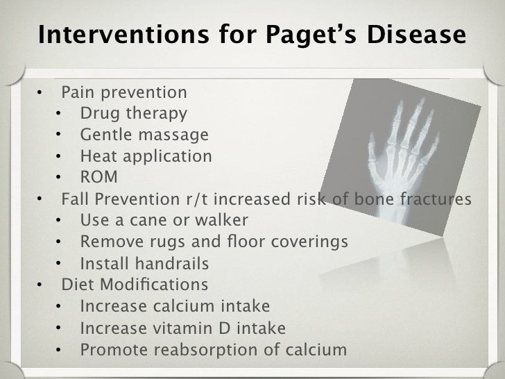 Paget's disease group project