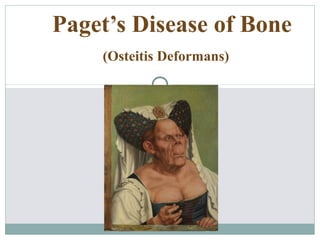 Paget’s Disease of Bone
(Osteitis Deformans)
 