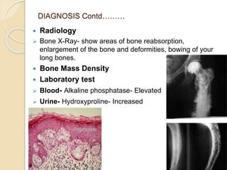 DIAGNOSIS Contd………
 Radiology
 Bone X-Ray- show areas of bone reabsorption,
enlargement of the bone and deformities, bowing of your
long bones.
 Bone Mass Density
 Laboratory test
 Blood- Alkaline phosphatase- Elevated
 Urine- Hydroxyproline- Increased
 Bone Biopsy
 