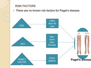 RISK FACTORS
 There are no known risk factors for Paget’s disease.
Older
than 40
year
Men
more
than
Female
Close
relative
AGE
SEX
FAMILY
HISTOR
Y
Paget’s disease
 