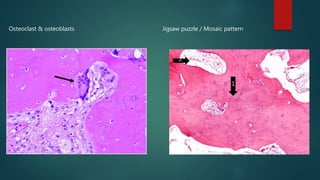 Osteoclast & osteoblasts Jigsaw puzzle / Mosaic pattern
1
2
 