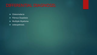 DIFFERENTIAL DIAGNOSIS:
 Osteomalacia
 Fibrous Dysplasia
 Multiple Myeloma
 osteopetrosis
 