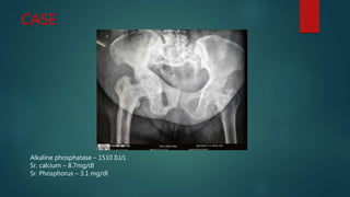 CASE
Alkaline phosphatase – 1510 IU/L
Sr. calcium – 8.7mg/dl
Sr. Phosphorus – 3.1 mg/dl
 