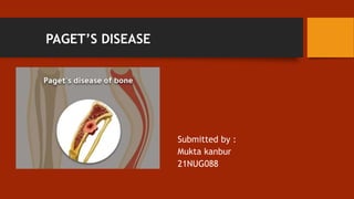 PAGET’S DISEASE
Submitted by :
Mukta kanbur
21NUG088
Submitted by
Mukta S Kanabur
21NUG088
 