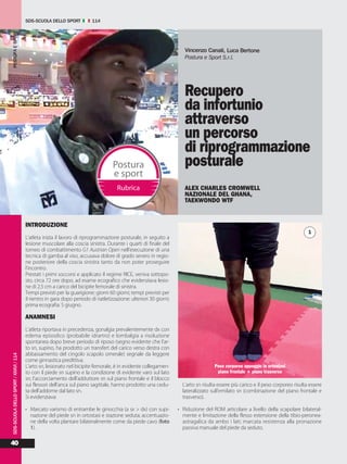 SDS-SCUOLA DELLO SPORT 114
40
POSTURAESPORTSDS-SCUOLADELLOSPORT/XXXVI/114
INTRODUZIONE
L’atleta inizia il lavoro di riprogrammazione posturale, in seguito a
lesione muscolare alla coscia sinistra. Durante i quarti di finale del
torneo di combattimento G1 Austrian Open nell’esecuzione di una
tecnica di gamba al viso, accusava dolore di grado severo in regio-
ne posteriore della coscia sinistra tanto da non poter proseguire
l’incontro.
Prestati i primi soccorsi e applicato il regime RICE, veniva sottopo-
sto, circa 72 ore dopo, ad esame ecografico che evidenziava lesio-
ne di 2,5 cm a carico del bicipite femorale di sinistra.
Tempi previsti per la guarigione: giorni 60 giorni; tempi previsti per
il rientro in gara dopo periodo di riatletizzazione: ulteriori 30 giorni;
prima ecografia: 5 giugno.
ANAMNESI
L’atleta riportava in precedenza, gonalgia prevalentemente dx con
edema episodico (probabile idrartro) e lombalgia a risoluzione
spontanea dopo breve periodo di riposo (segno evidente che l’ar-
to sn, supino, ha prodotto un transfert del carico verso destra con
abbassamento del cingolo scapolo omerale) segnale da leggere
come ginnastica predittiva.
L’arto sn, lesionato nel bicipite femorale, è in evidente collegamen-
to con il piede sn supino e la condizione di evidente varo sul lato
sn; l’accorciamento dell’adduttore sn sul piano frontale e il blocco
sui flessori dell’anca sul piano sagittale, hanno prodotto una cedu-
ta dell’addome dal lato sn.
Si evidenziava:
• Marcato varismo di entrambe le ginocchia (a sx > dx) con supi-
nazione del piede sn in ortostasi e stazione seduta; accentuazio-
ne della volta plantare bilateralmente come da piede cavo (foto
1).
L’arto sn risulta essere più carico e il peso corporeo risulta essere
lateralizzato sull’emilato sn (combinazione del piano frontale e
trasverso).
• Riduzione del ROM articolare a livello della scapolare bilateral-
mente e limitazione della flesso estensione della tibio-peronea-
astragalica da ambo i lati; marcata resistenza alla pronazione
passiva manuale del piede da seduto.
1
Postura
e sport
Rubrica
Recupero
da infortunio
attraverso
un percorso
di riprogrammazione
posturale
ALEX CHARLES CROMWELL
NAZIONALE DEL GHANA,
TAEKWONDO WTF
Vincenzo Canali, Luca Bertone
Postura e Sport S.r.l.
Peso corporeo appoggio in ortostasi
piano frontale + piano trasverso
 
