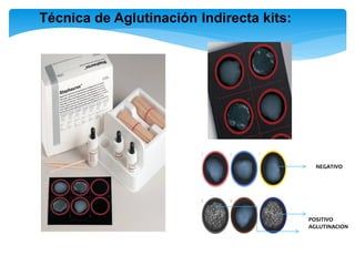 Técnica de Aglutinación Indirecta kits:
POSITIVO
AGLUTINACION
NEGATIVO
 