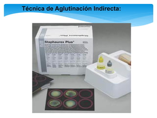 Técnica de Aglutinación Indirecta:
 