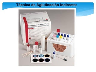 Técnica de Aglutinación Indirecta:
 