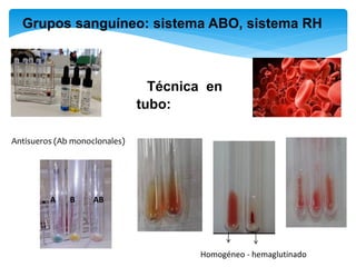A B AB
Técnica en
tubo:
Grupos sanguíneo: sistema ABO, sistema RH
Homogéneo - hemaglutinado
Antisueros (Ab monoclonales)
 