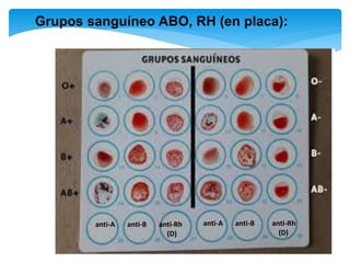 anti-A anti-B anti-Rh
(D)
anti-A anti-B anti-Rh
(D)
Grupos sanguíneo ABO, RH (en placa):
 