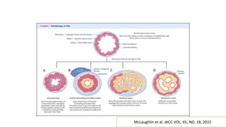 Recent advances in the management of pulmonary arterial hypertension | PPTX
