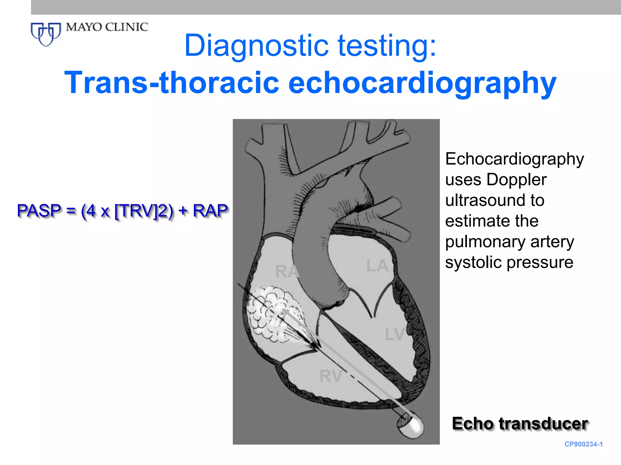 Pulmonary artery hypertension | PPT