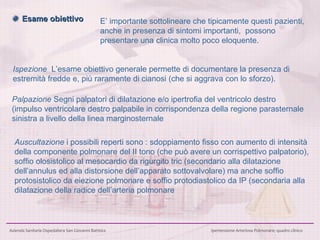    Esame obiettivo E’ importante sottolineare che tipicamente questi pazienti, anche in presenza di sintomi importanti,  possono presentare una clinica molto poco eloquente. Auscultazione  i possibili reperti sono : sdoppiamento fisso con aumento  di intensità della componente polmonare del II tono (che può avere un corrispettivo palpatorio),  soffio olosistolico al mesocardio da rigurgito tric (secondario alla dilatazione dell’annulus ed alla distorsione dell’apparato sottovalvolare)   ma anche soffio protosistolico da eiezione polmonare   e soffio protodiastolico da  IP (secondaria alla dilatazione della radice dell’arteria polmonare Ispezione  L’esame obiettivo generale permette di documentare la presenza di estremità fredde e, più raramente di cianosi (che si aggrava con lo sforzo). Palpazione  Segni palpatori di dilatazione e/o ipertrofia del ventricolo destro  (impulso ventricolare destro palpabile in corrispondenza della regione parasternale sinistra a livello della linea marginosternale 