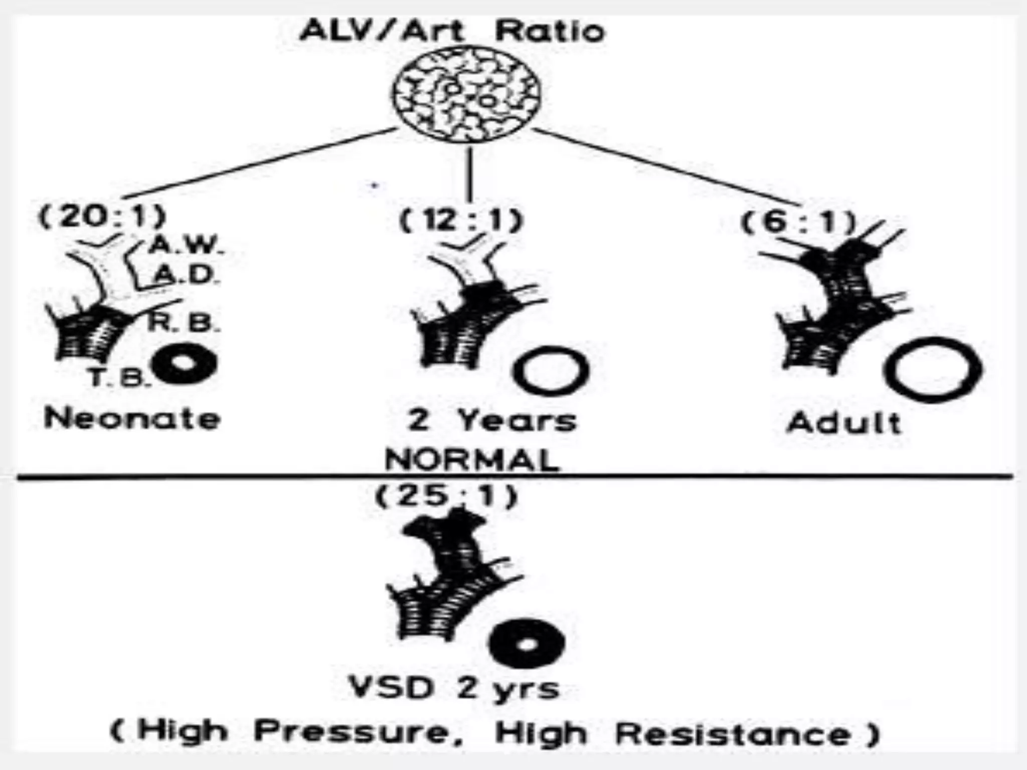 Pulmonary arterial hypertension (PAH) in ccongenital heart diseases | PPT