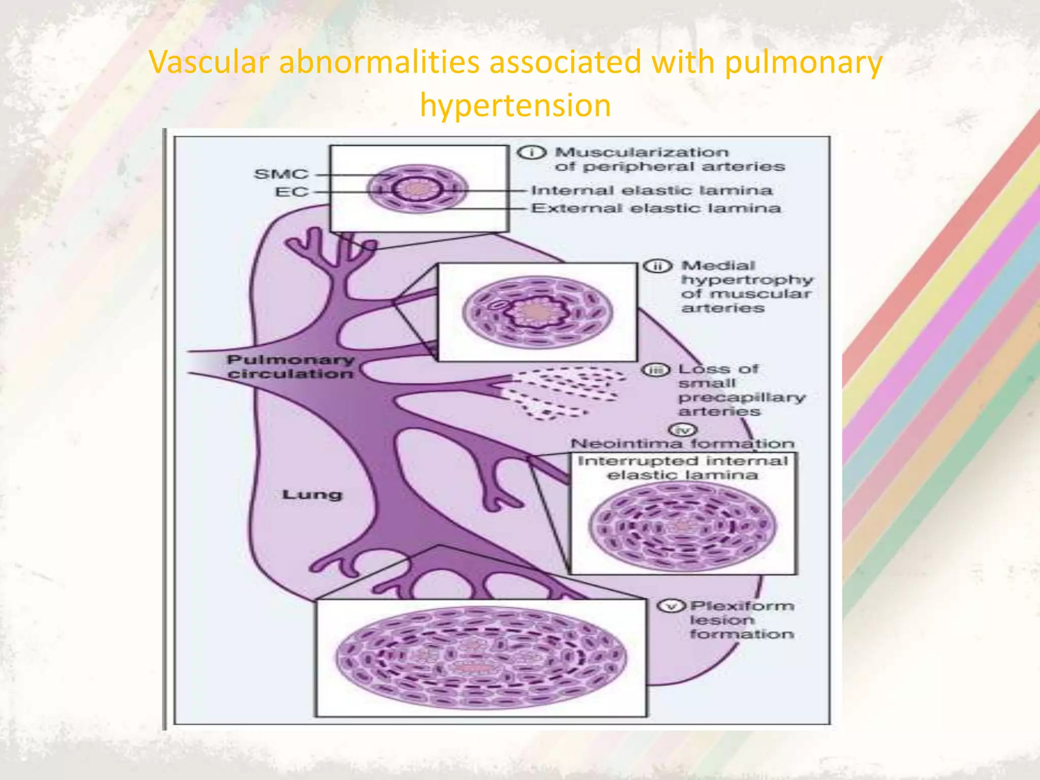 Pulmonary arterial hypertension (PAH) in ccongenital heart diseases | PPT