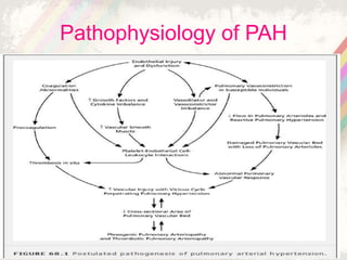 Pulmonary arterial hypertension (PAH) in ccongenital heart diseases | PPTX