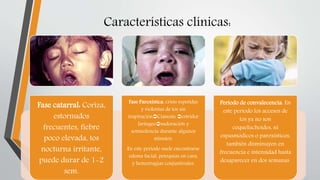 Características clínicas:
Fase catarral: Coriza,
estornudos
frecuentes, fiebre
poco elevada, tos
nocturna irritante,
puede durar de 1-2
sem.
Fase Paroxística. crisis repetidas
y violentas de tos sin
inspiraciónCianosis estridor
laríngeosudoración y
somnolencia durante algunos
minutos.
En este período suele encontrarse
edema facial, petequias en cara,
y hemorragias conjuntivales.
Período de convalecencia. En
este período los accesos de
tos ya no son
coqueluchoides, ni
espasmódicos o paroxísticos,
también disminuyen en
frecuencia e intensidad hasta
desaparecer en dos semanas.
 