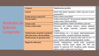 Síndrome de
Rubéola
Congénita
 