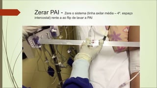 Zerar PAI - Zere o sistema (linha axilar média – 4º. espaço
intercostal) rente a ao flip de lavar a PAI
 