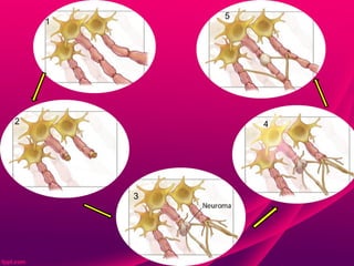 5
    1




2               4




        3
 