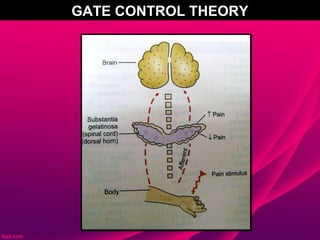 GATE CONTROL THEORY
 
