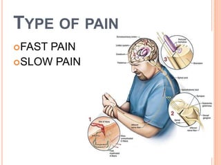TYPE OF PAIN 
FAST PAIN 
SLOW PAIN 
 