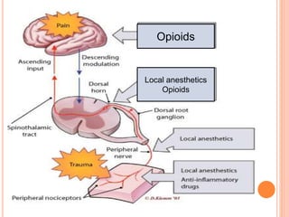 Opioids 
Local anesthetics 
Opioids 
 