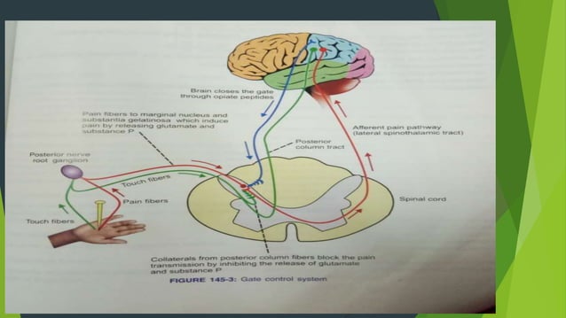 Pain definition, pathway,analgesic pathway, types of pain | PPTX
