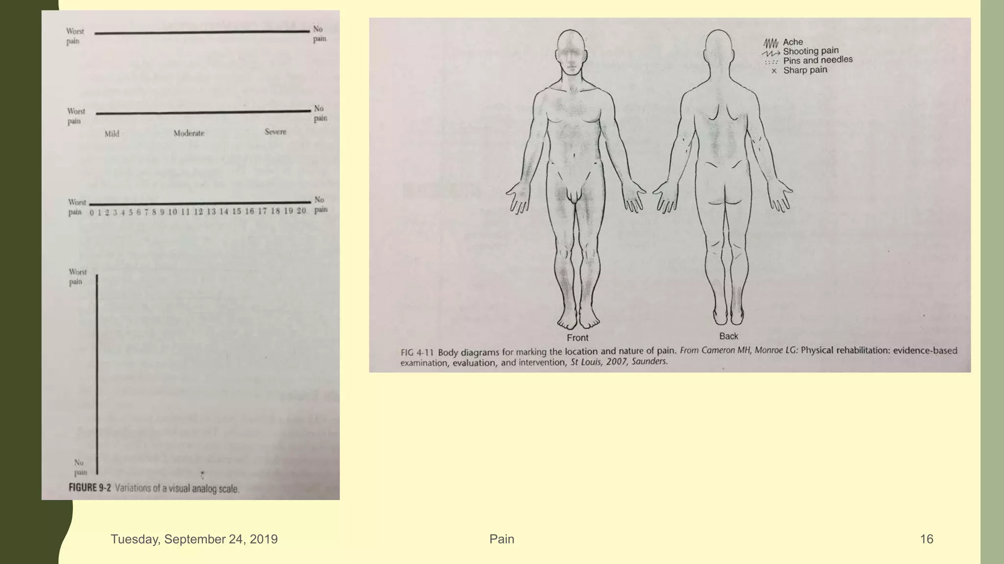Neuropathic Pain Scale | PainScale, image size:2048x1152