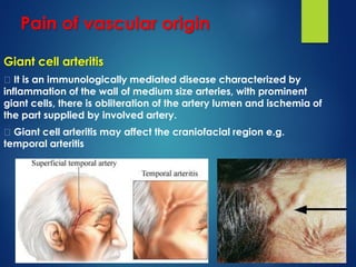 Pain of vascular origin
Giant cell arteritis
It is an immunologically mediated disease characterized by
inflammation of the wall of medium size arteries, with prominent
giant cells, there is obliteration of the artery lumen and ischemia of
the part supplied by involved artery.
Giant cell arteritis may affect the craniofacial region e.g.
temporal arteritis
 