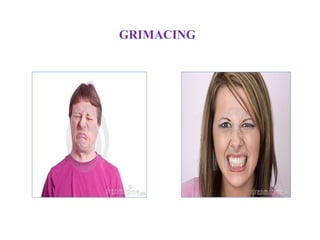 GRIMACING
 
