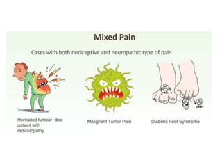 Pain and its types with pain assessment scale | PPTX