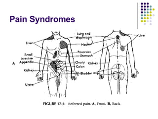 Pain Syndromes 