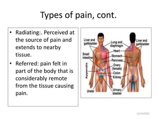 Organ Radiating Pain pain 4.pptx