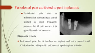 Periodontal pain attributed to peri implantitis
 Periodontal pain due to
inflammation surrounding a dental
implant is most frequently
painless, but if pain occurs it is
typically moderate to severe.
Diagnostic criteria
 Periodontal pain that it involves an implant and not a natural tooth,
Clinical and/or radiographic evidence of a peri-implant infection
 