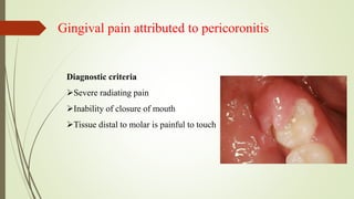 Gingival pain attributed to pericoronitis
Diagnostic criteria
Severe radiating pain
Inability of closure of mouth
Tissue distal to molar is painful to touch
 