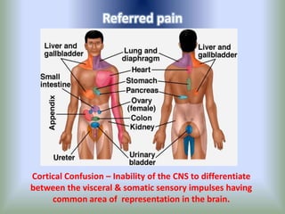 Referred pain
Cortical Confusion – Inability of the CNS to differentiate
between the visceral & somatic sensory impulses having
common area of representation in the brain.
 