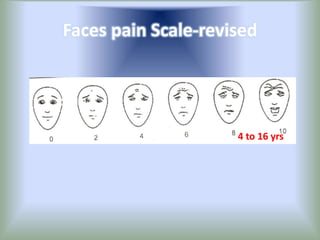 Faces pain Scale-revised
4 to 16 yrs
 