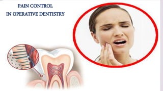 PAIN CONTROL
IN OPERATIVE DENTISTRY
 